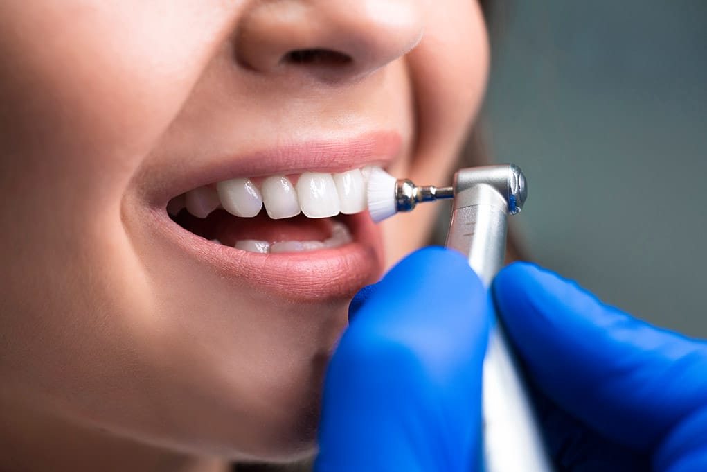 periodontitis